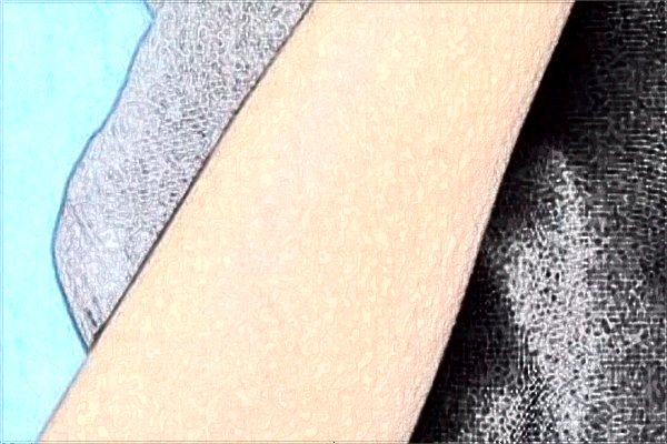 南京市中醫(yī)院激光脫毛哪位醫(yī)生做的好_收費(fèi)貴不貴