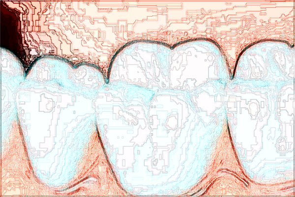 2024淮北市人民醫(yī)院口腔科怎么樣_口腔科收費(fèi)標(biāo)準(zhǔn)
