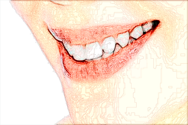 上海曙光醫(yī)院補(bǔ)牙怎么樣_做的好不好