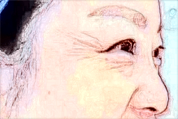 福州總醫(yī)院祛斑如何?福州總醫(yī)院祛斑價(jià)格是多少