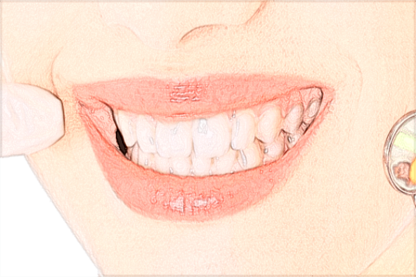 2024北京大學(xué)第一醫(yī)院口腔科焦洋醫(yī)生簡介_附案例