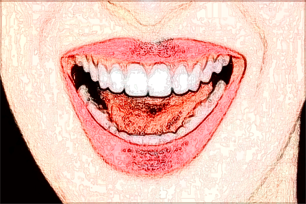 北大口腔醫(yī)院前牙修復(fù)價(jià)目表(價(jià)格表)怎么樣