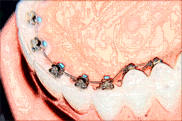2024上海曙光醫(yī)院種植牙怎么樣_做的好不好