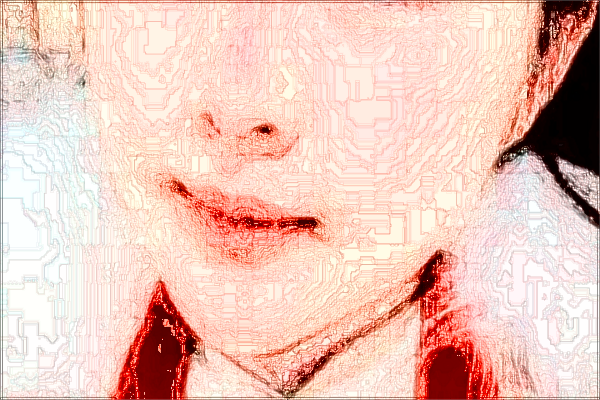 2024上海曙光醫(yī)院去胎記怎么樣_技術好的醫(yī)生有哪些