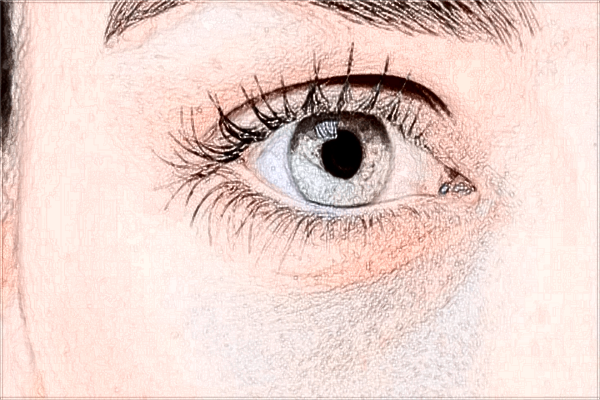 2024廈門(mén)市第一醫(yī)院做眼皮松弛下垂矯正手術(shù)怎么樣?收費(fèi)價(jià)格