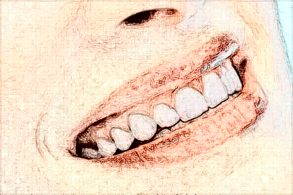 2024六安市人民醫(yī)院口腔科怎么樣_價(jià)格貴不貴