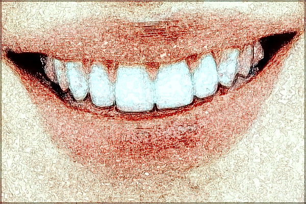 河北省口腔醫(yī)院隱形矯正價格表_做的怎么樣