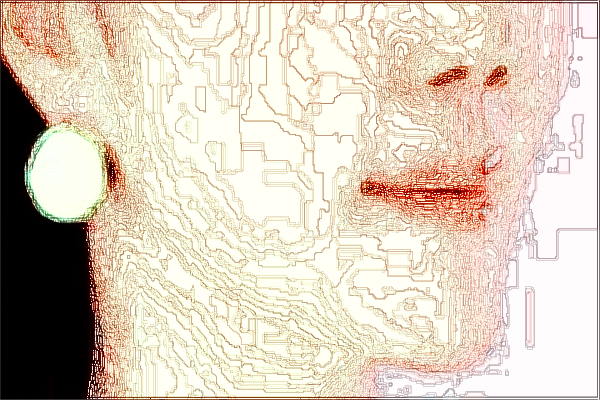 上海曙光醫(yī)院激光祛斑價(jià)目表(價(jià)格表)怎么樣