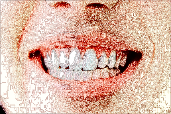 2024河北省口腔醫(yī)院種牙價(jià)目表(價(jià)格表)怎么樣