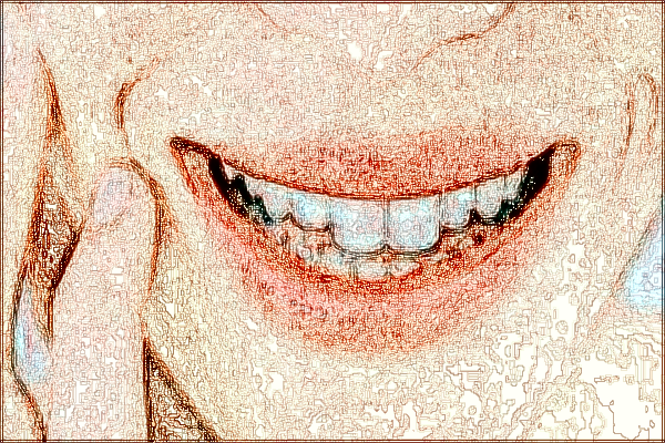 河北省口腔醫(yī)院烤瓷牙多少錢_烤瓷牙和全瓷牙的區(qū)別哪個好