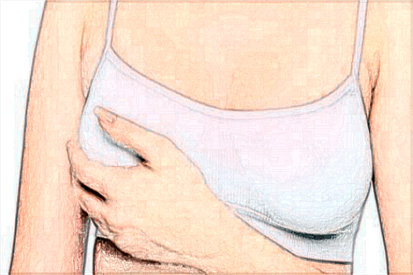 河科大二附院隆胸技術(shù)好不好?2024隆胸手術(shù)整形價格