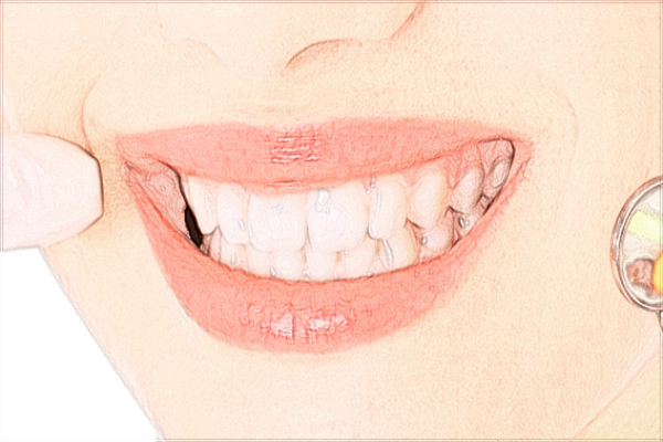 寧波市第一醫(yī)院牙齒矯正怎么樣、醫(yī)生做的好不好?