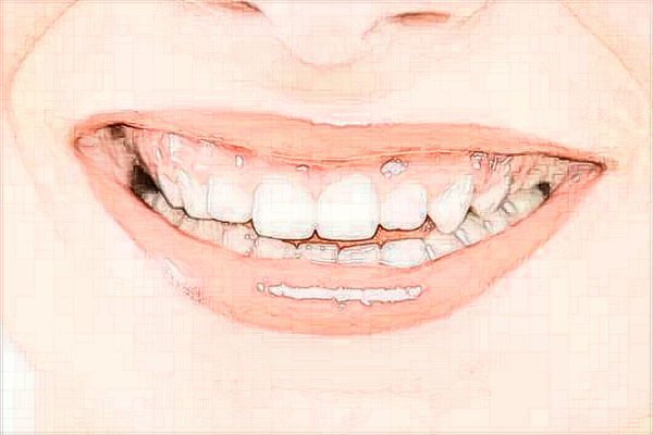 寧波市第一醫(yī)院牙齒矯正怎么樣、醫(yī)生做的好不好?