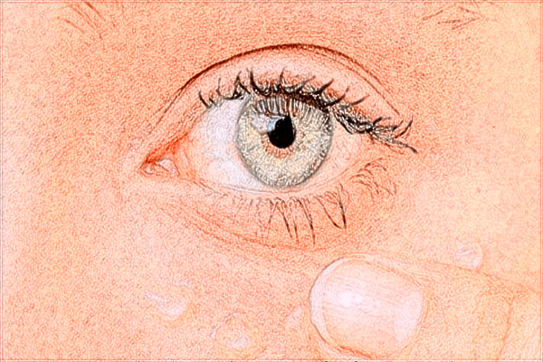 泰安市中醫(yī)二院眼部修復(fù)好嗎?2024眼部修復(fù)價格曝光