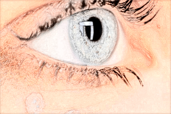 河科大二附院去眼袋技術(shù)怎么樣?2024去眼袋手術(shù)價格