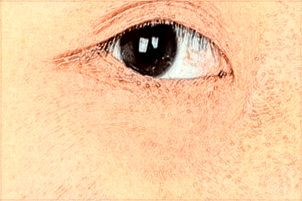 河科大二附院做怎么樣?2024手術(shù)價格曝光