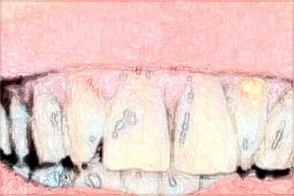 福建醫(yī)科大學(xué)附屬第二醫(yī)院好不好?福建醫(yī)科大學(xué)附屬第二醫(yī)院口腔科在哪里