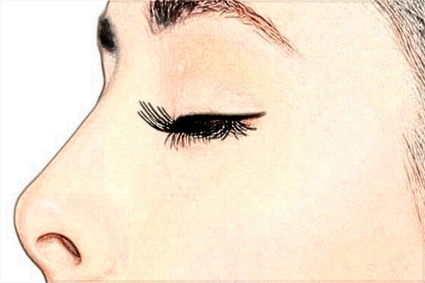 2024泰安市中醫(yī)二院做隆鼻價格_隆鼻可以只墊山根嗎