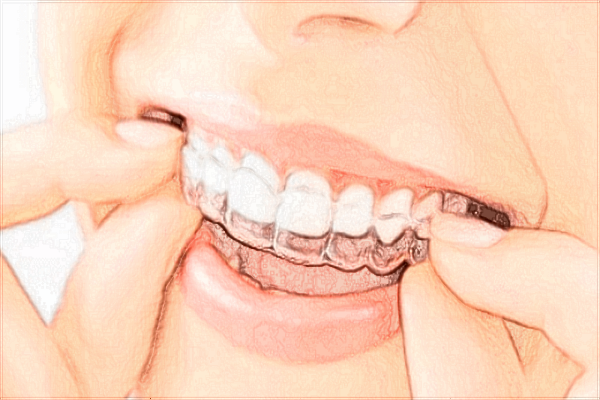 浙江省中醫(yī)院種植牙怎么樣_大概需要多少錢