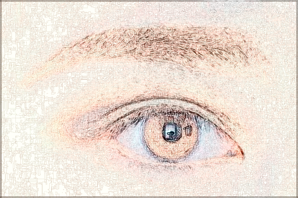 2024上海同濟(jì)醫(yī)院祛疤案例_做的怎么樣