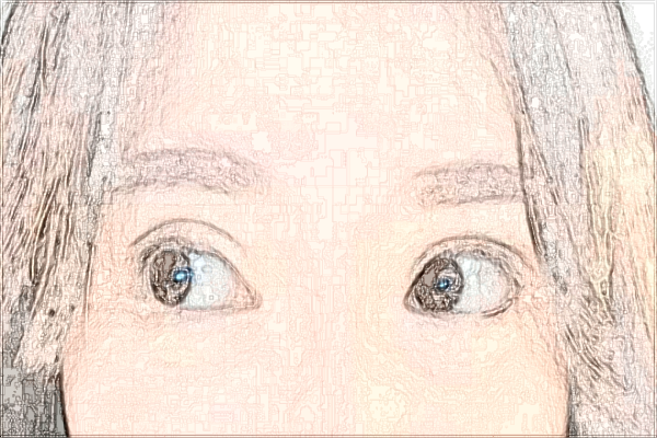 淮北市人民醫(yī)院祛痣多少錢【去痣案例】