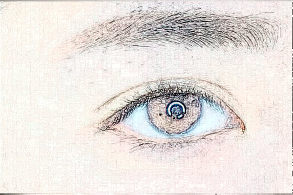 浙江省中醫(yī)院激光去黑眼圈好嗎?去黑眼圈會(huì)不會(huì)反彈