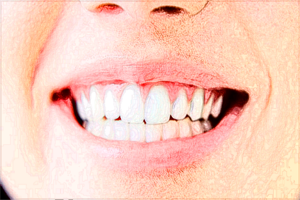 北大口腔醫(yī)院地包天正頜多少錢_怎么樣