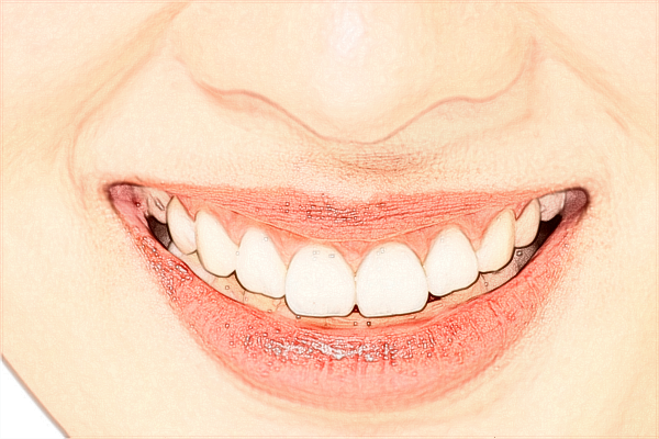 溫州醫(yī)學院附屬第一醫(yī)院種牙做的好嗎_哪位醫(yī)生做的好