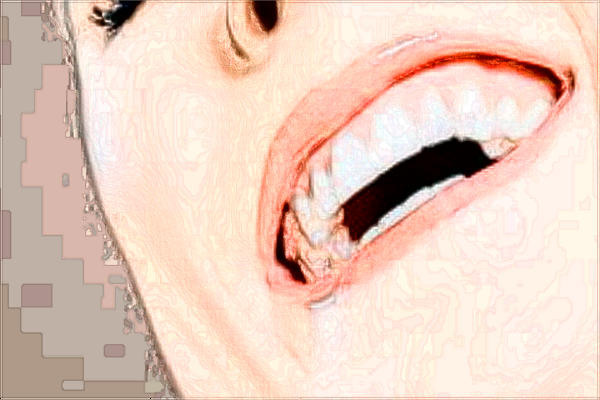 北大口腔醫(yī)院補牙的費用是多少_哪個醫(yī)生做的好