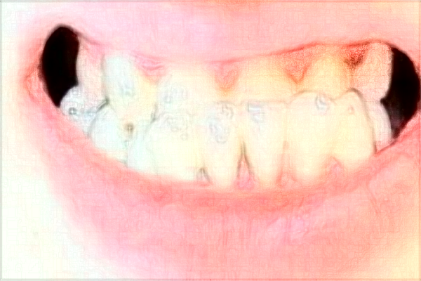 南昌大學(xué)第二附屬醫(yī)院牙科怎么樣?2024牙科收費(fèi)價(jià)位