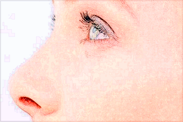 2024廣州華美鼻子哪個醫(yī)生做的好【做鼻子案例】