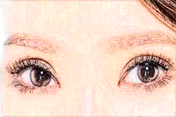 北大醫(yī)院割雙眼皮怎樣_哪個醫(yī)生做得好