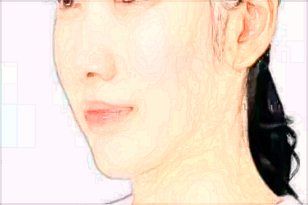 成都華西醫(yī)院拉皮怎么樣_哪些醫(yī)生做的比較好