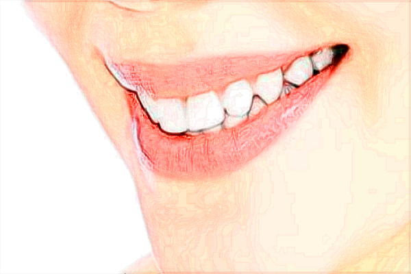 廣州華美種牙技術(shù)怎么樣_醫(yī)生推薦