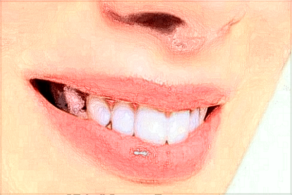 南昌大學(xué)第二附屬醫(yī)院正畸可以么?正畸牙齒的費(fèi)用2024