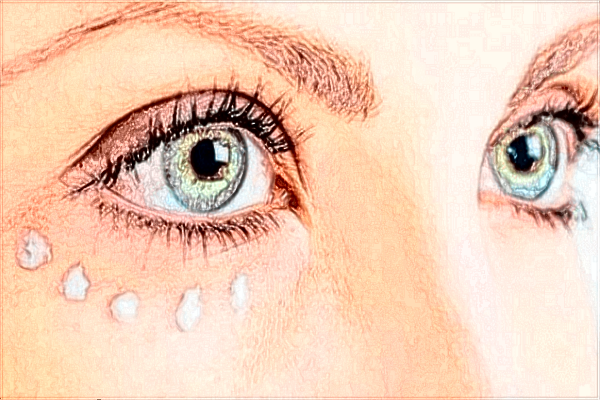 南昌大學第一附屬醫(yī)院去斑怎么樣?2024激光祛斑價格