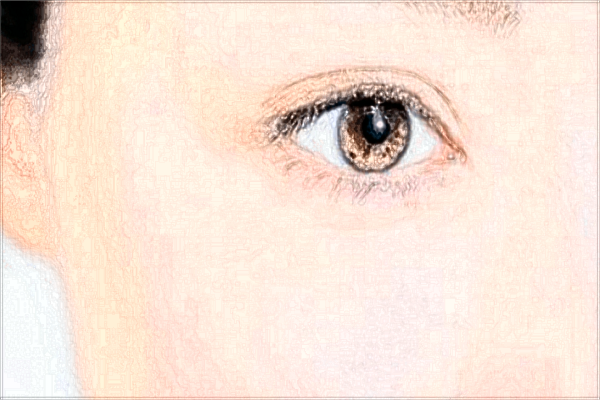 南昌大學(xué)第一附屬醫(yī)院雙眼皮手術(shù)醫(yī)生好嗎?2024雙眼皮多少錢(qián)