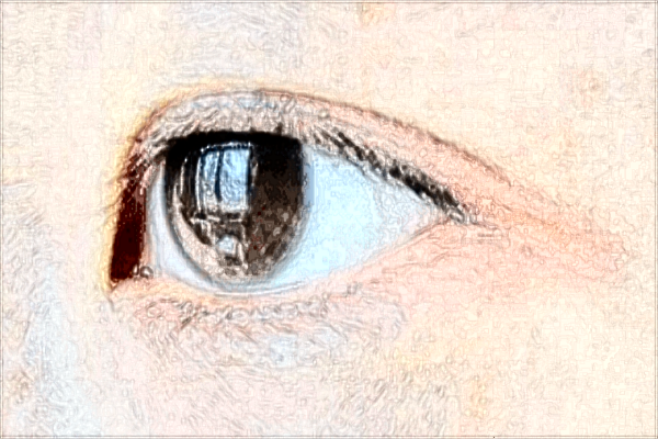 南昌大學(xué)第一附屬醫(yī)院雙眼皮手術(shù)醫(yī)生好嗎?2024雙眼皮多少錢(qián)