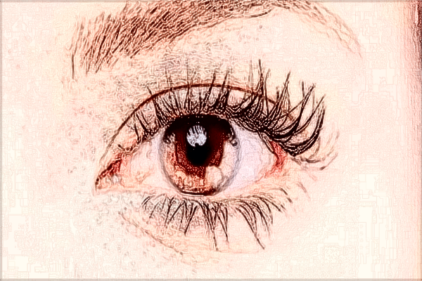 2024無(wú)錫市第二人民醫(yī)院去眼袋做的怎么樣_案例+價(jià)格