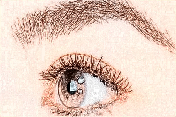 2024無(wú)錫市第二人民醫(yī)院去眼袋做的怎么樣_案例+價(jià)格