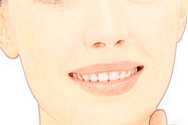 2024河北省人民醫(yī)院祛斑需要多少錢_價格+案例