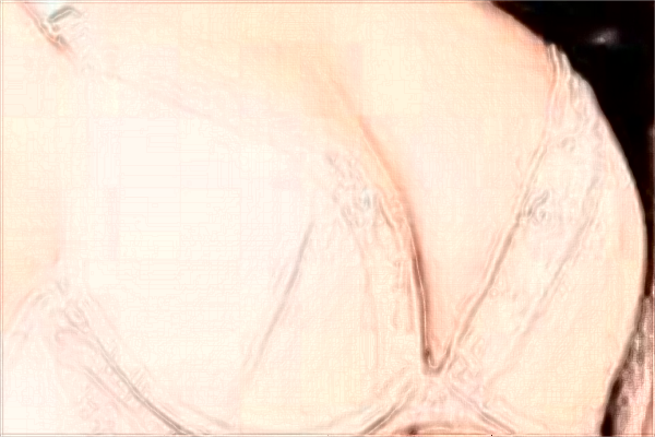 無錫市第二人民醫(yī)院整形美容科技術(shù)好的醫(yī)生有哪些