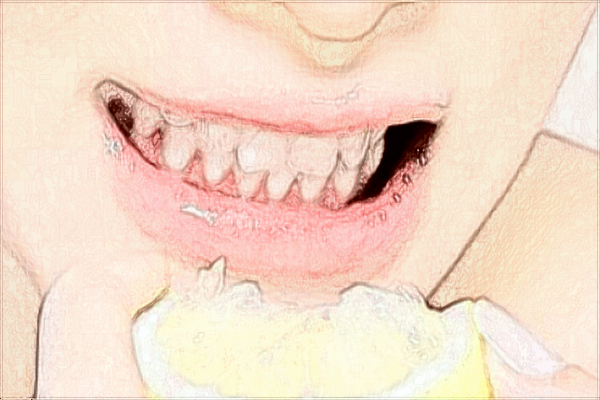 2024江蘇省口腔醫(yī)院牙齒美白做的好嗎_技術(shù)怎么樣