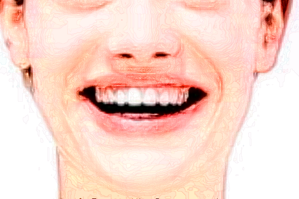 2024四川華西醫(yī)院口腔科怎么樣_好的醫(yī)生有哪些