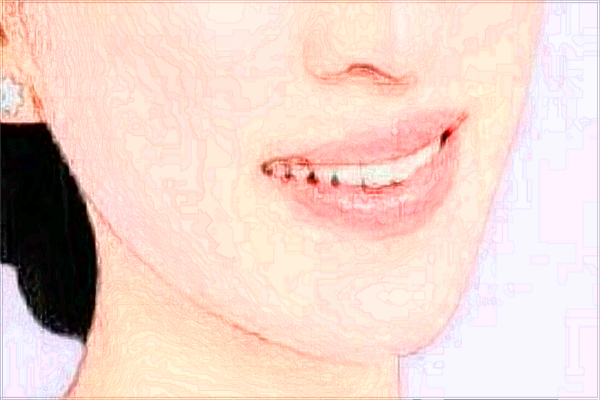 寧波市第一醫(yī)院祛痘價(jià)目表(價(jià)格表)怎么樣