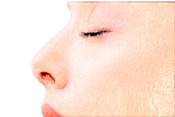 四川華西醫(yī)院激光美容價目表(價格表)怎么樣