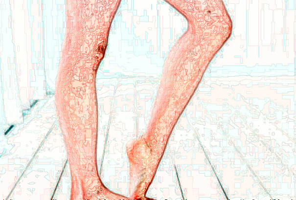 北京大學(xué)第一醫(yī)院洗紋身價(jià)目表(價(jià)格表)怎么樣