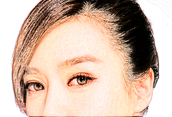 六安市人民醫(yī)院植發(fā)技術(shù)怎么樣【植發(fā)案例】