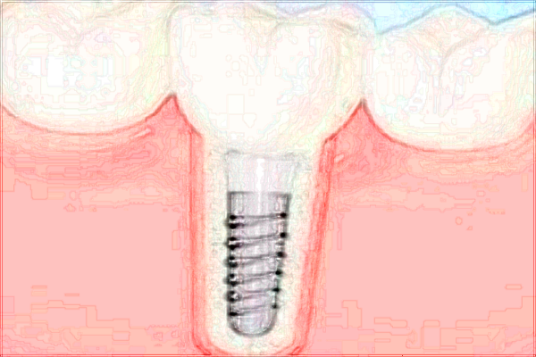 北京大學(xué)第一醫(yī)院口腔科王曉敏經(jīng)驗怎么樣_技術(shù)好不好