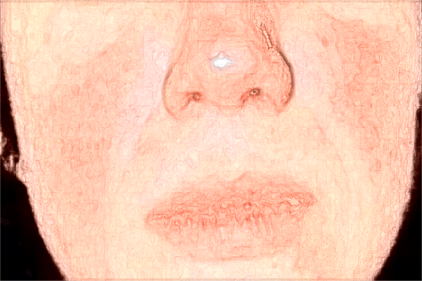 2024南昌大學(xué)第二附屬醫(yī)院光子嫩膚多少錢(qián)?光子嫩膚怎么樣